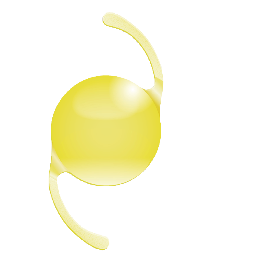 Implantate / IOL | Mediconsult Schweiz